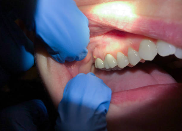 Best Urgent Tooth Repair  in South Zanesville, OH