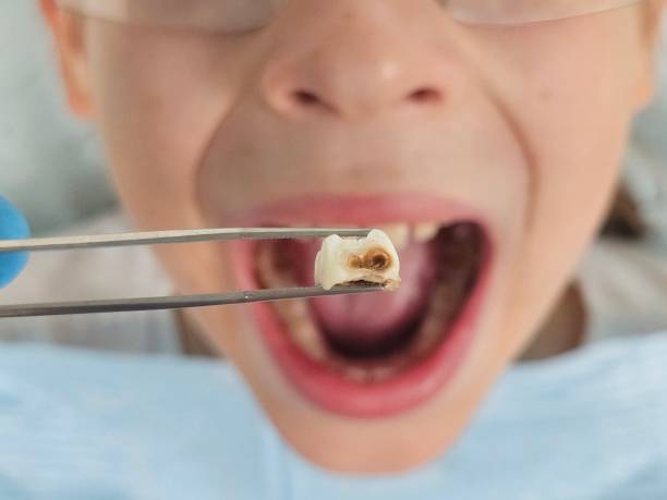 Best Emergency Pediatric Dentist  in South Zanesville, OH